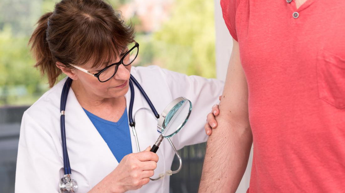 About Lichen Sclerosus