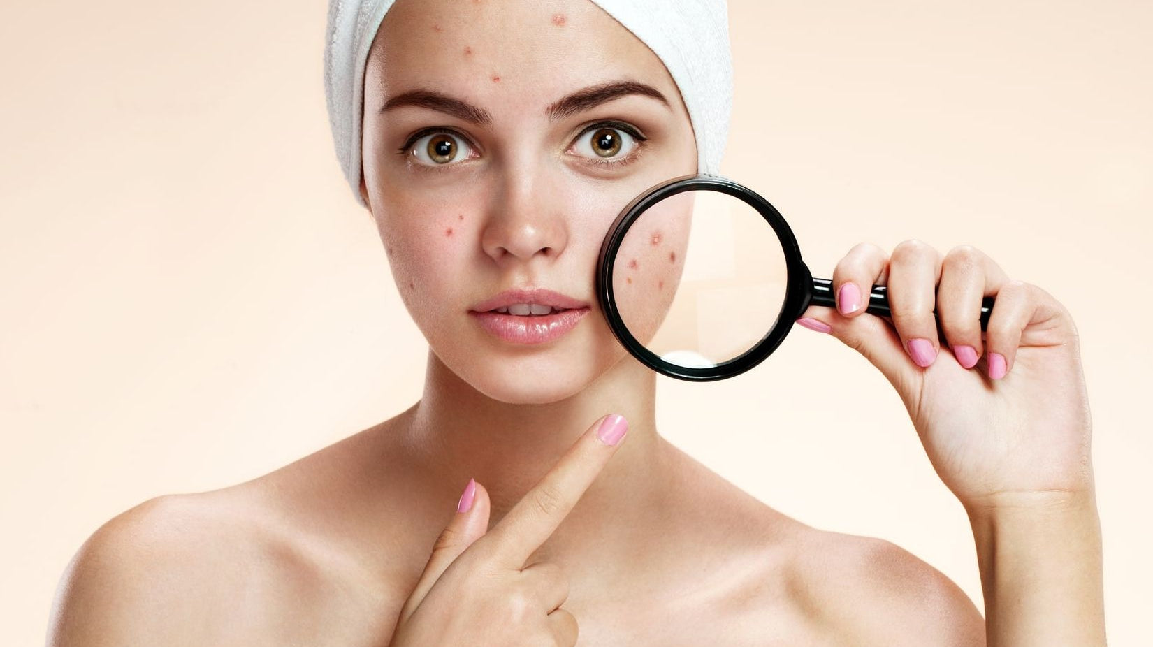 Acne Medication and Sexuality