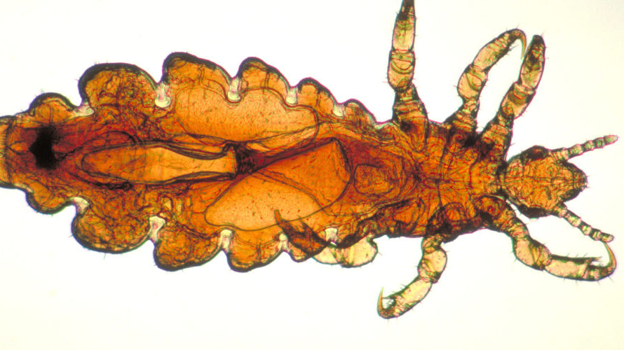 All you need to know about pubic lice