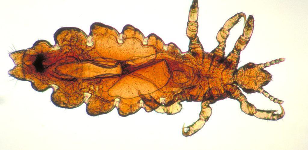 All you need to know about pubic lice