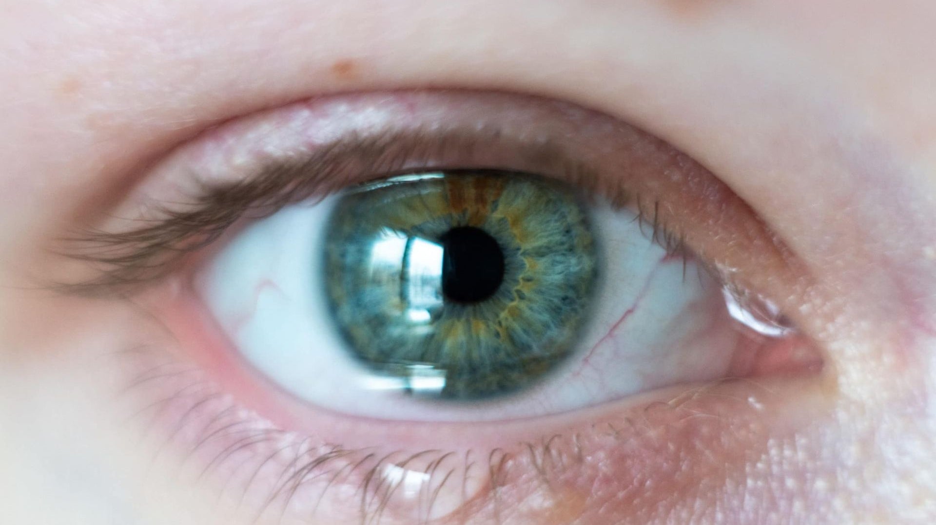 Are you suffering from dry eyes?