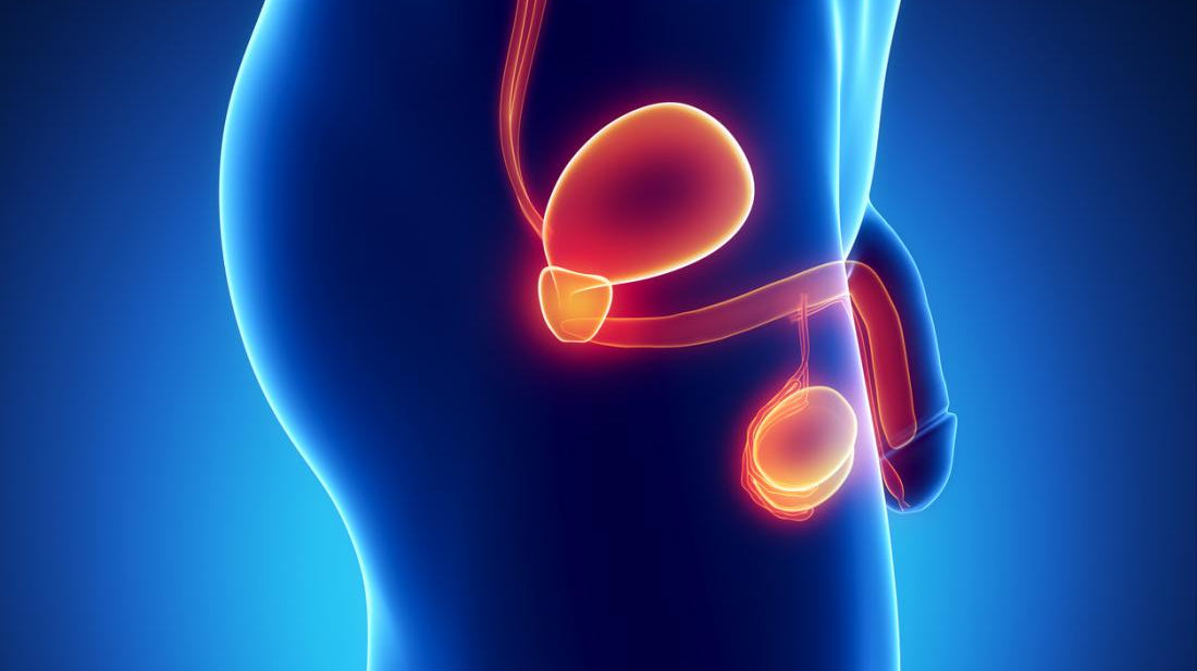 Possible Complications after a Vasectomy