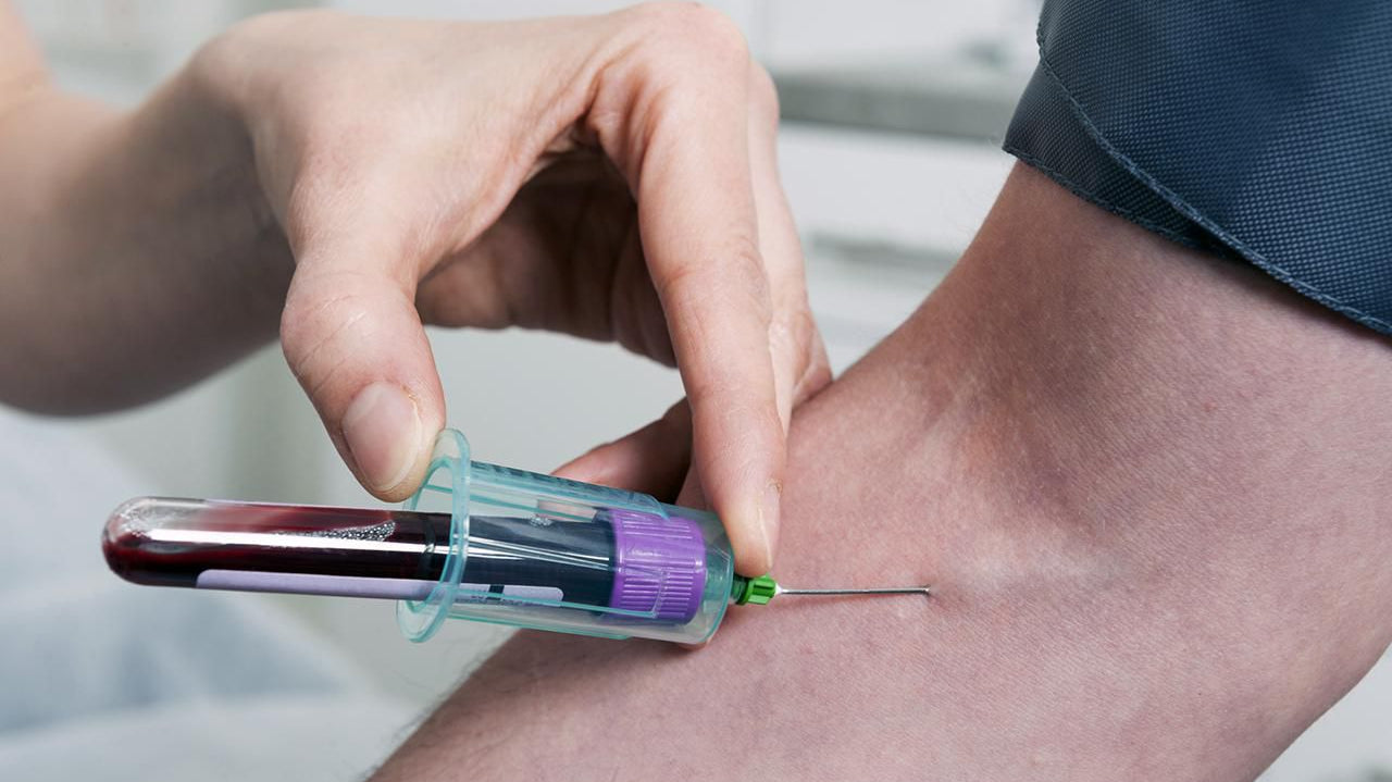 Testing For Genital Herpes