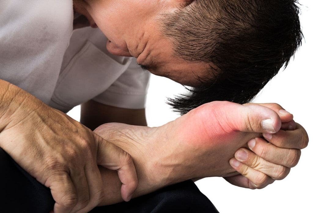 Gout can affect your sexual health and performance