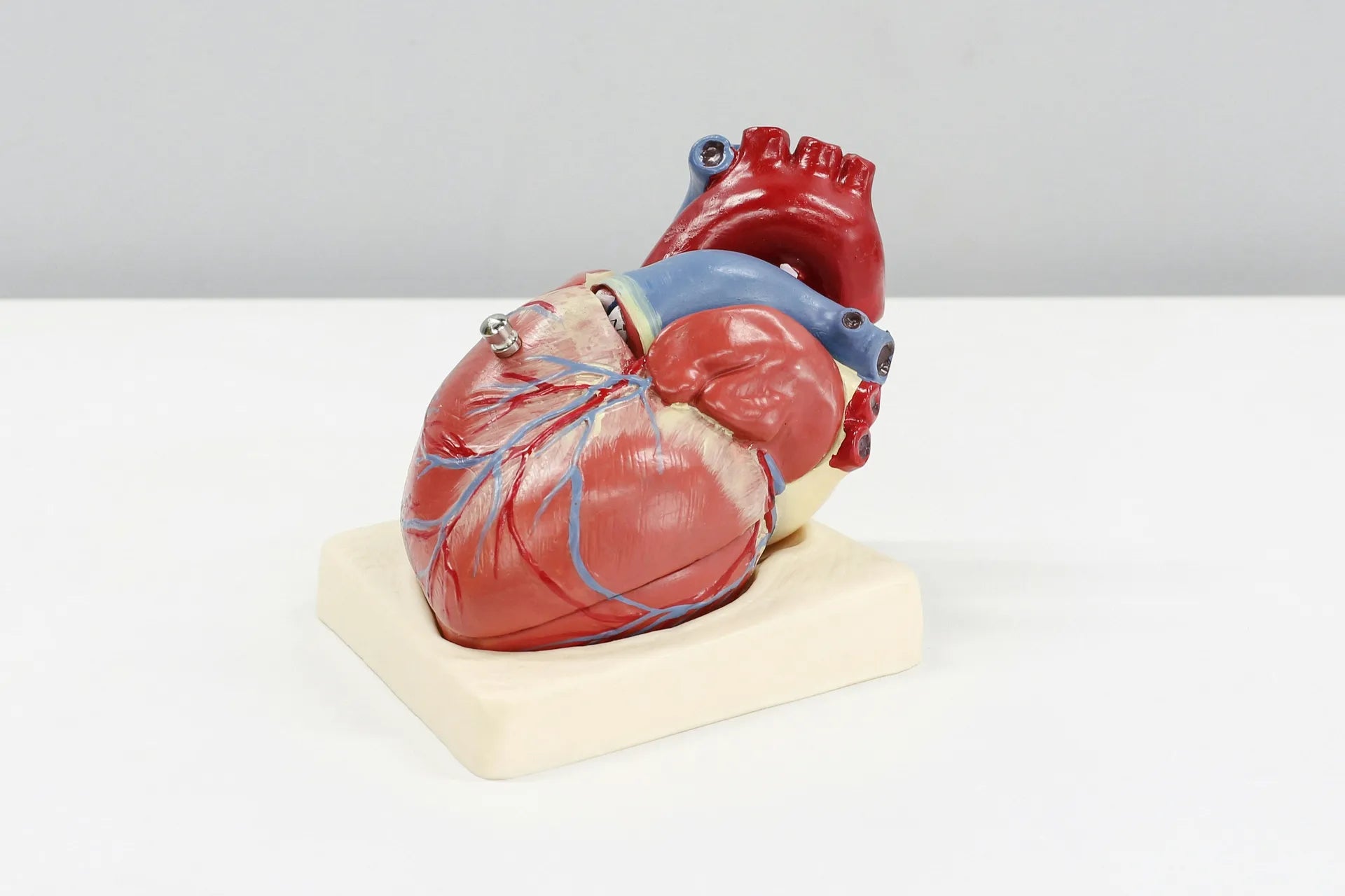 Cardiomegaly - enlarged heart